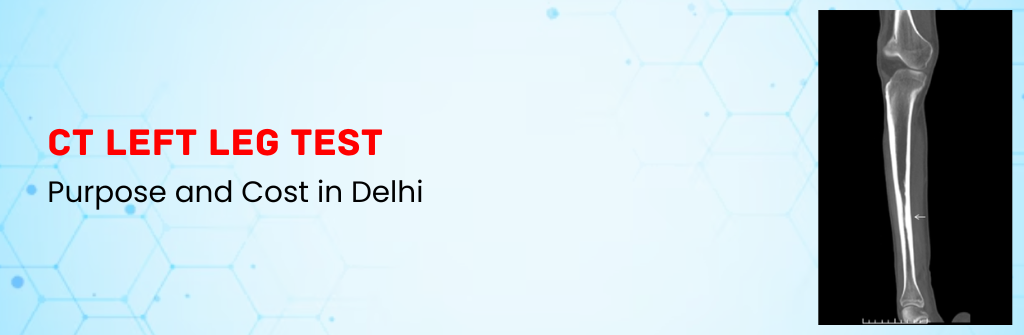  CT Left leg Test: Purpose and Cost in Delhi